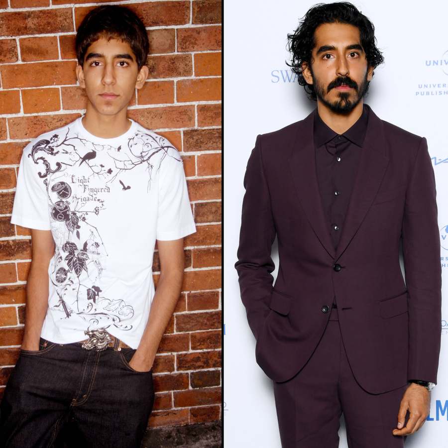 Skins UK Cast Where Are They Now Dev Patel