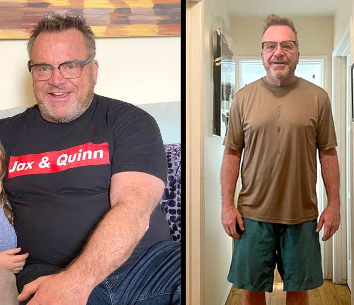 Tom Arnold shows dramatic 75 pounds weight loss after suffering a ministroke