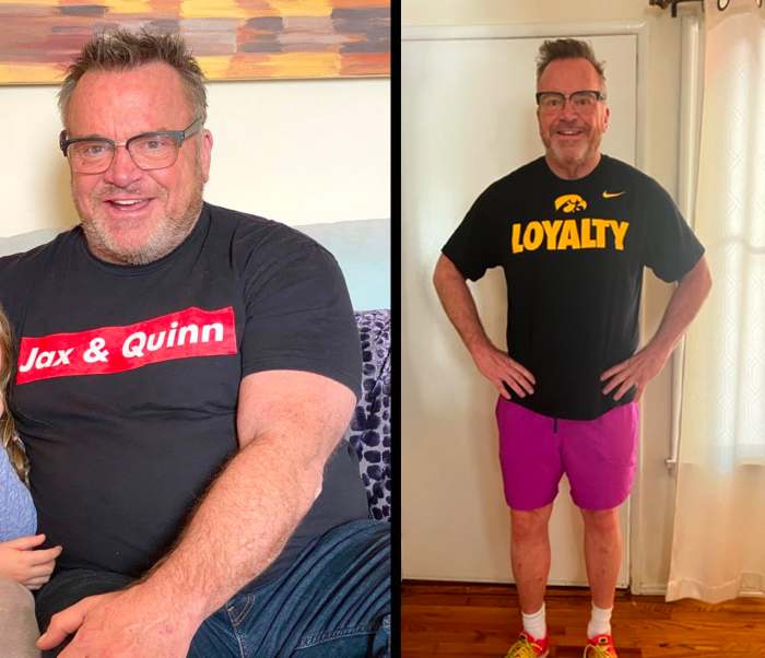 Tom Arnold shows a dramatic 75 pounds weight loss after suffering a ministroke