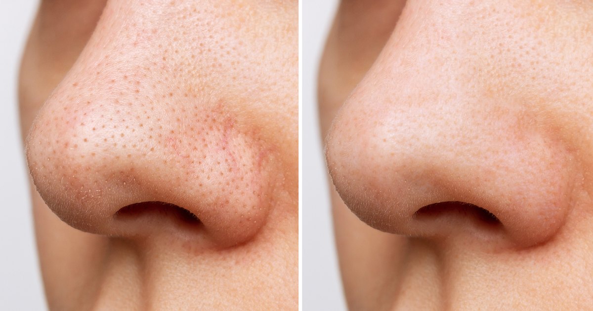 IT Cosmetics Bye Bye Pores Serum May Present Leads to Simply 1 Week IT Cosmetics Bye Bye Pores Serum May Present Leads to Simply 1 Week