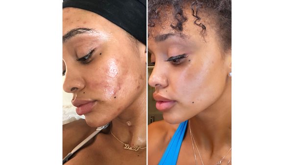 Gleamin before and after