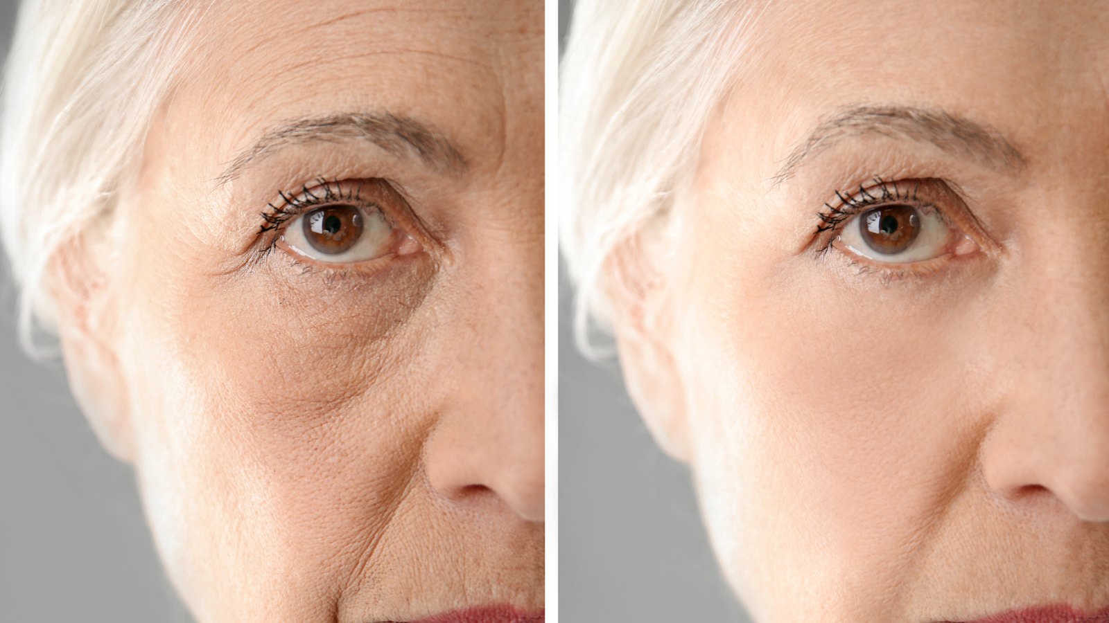 Anti-Aging-Before-After-Stock-Photo