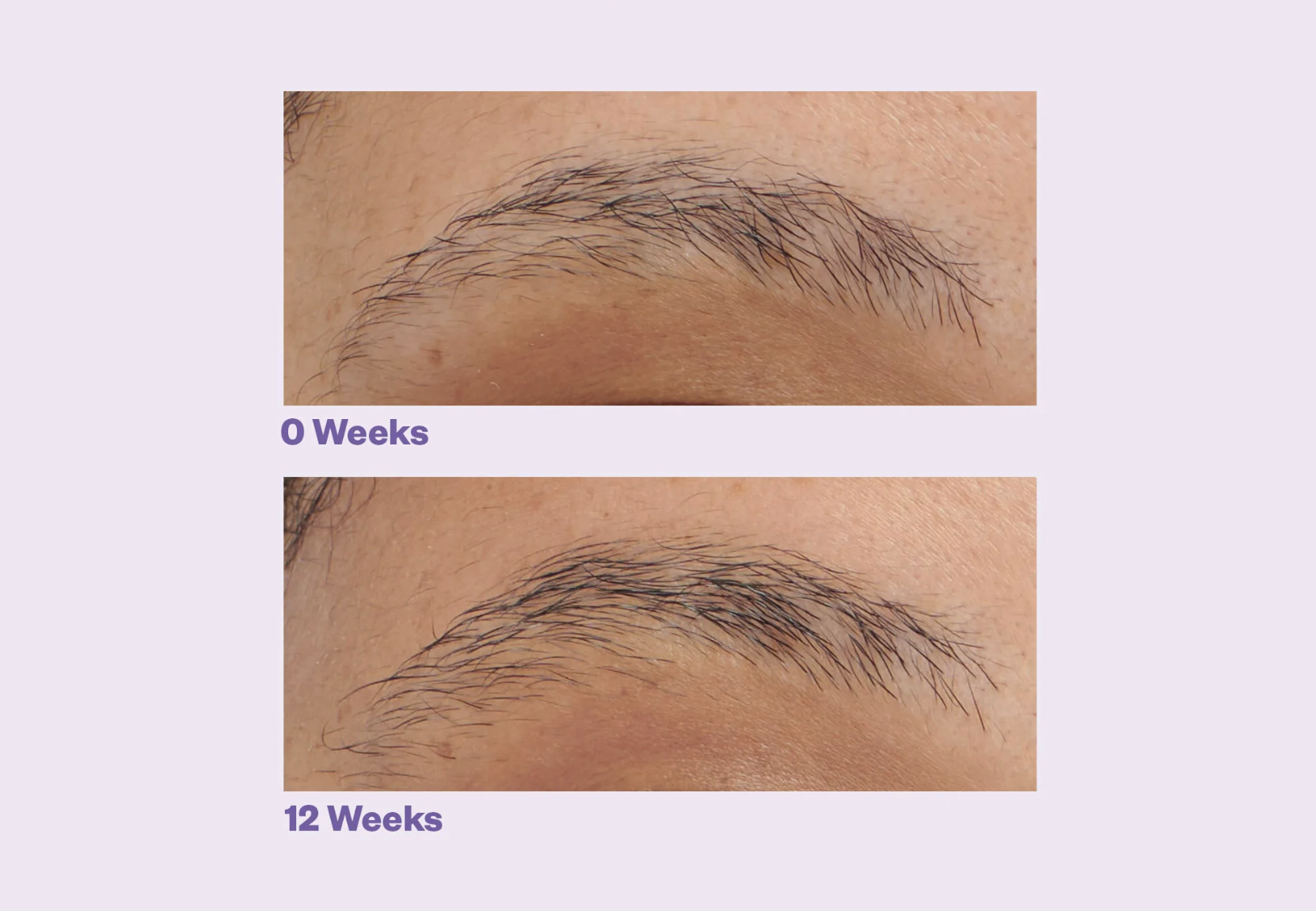 Overplucked? Users Saw a 97% Improvement in Their Brows With This Serum