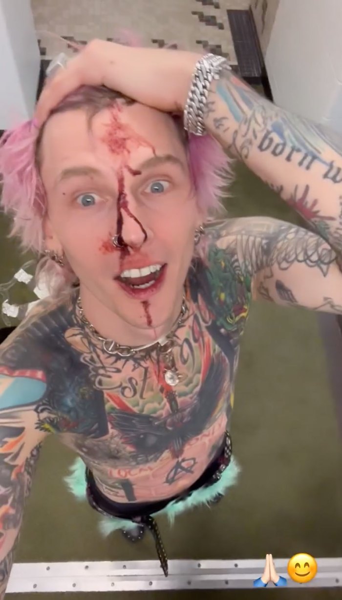 Machine Gun Kelly Shows Off Bloody Face After F–king Insane Cleveland Concert