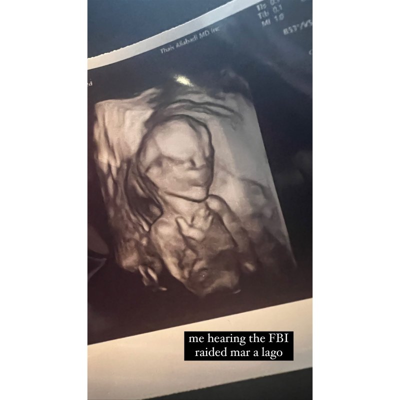 Pregnant Chrissy Teigen Shares Ultrasound Photo 2