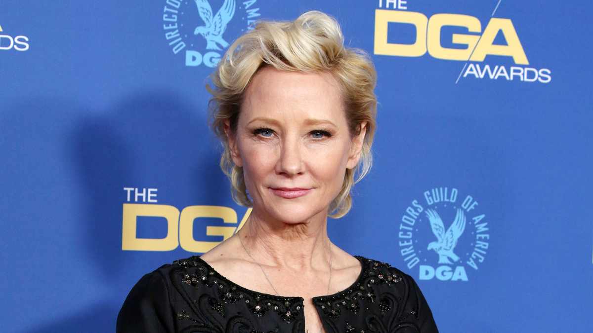 Anne Heche Severely Burned in Car Crash Fire, Hospitalized: Report