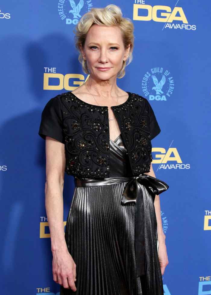 Anne Heche Hospitalized After Suffering Burns in Car Crash Fire: Report