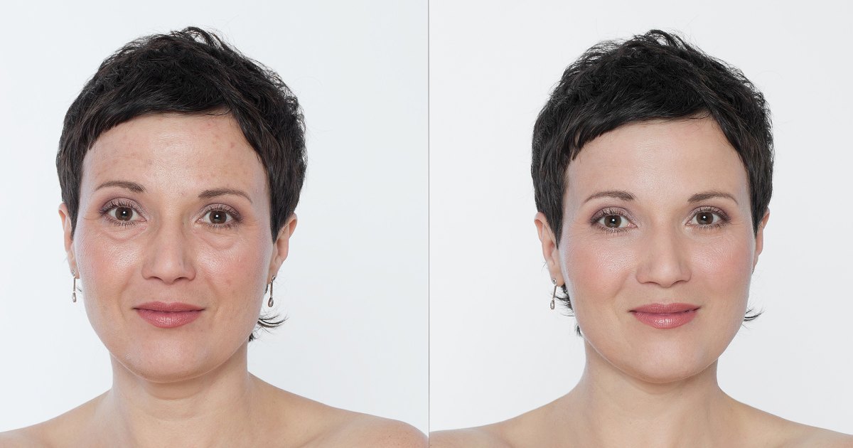 HUM Arctic Restore Includes a Critical Wrinkle-Buster — 30% Off HUM Arctic Restore Includes a Critical Wrinkle-Buster — 30% Off