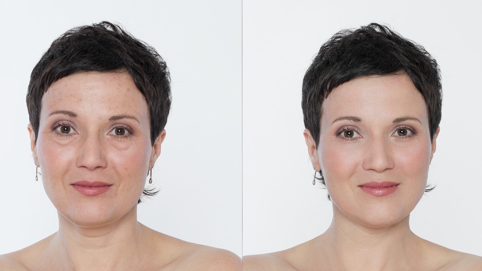 hum-arctic-repair-wrinkles-before-after