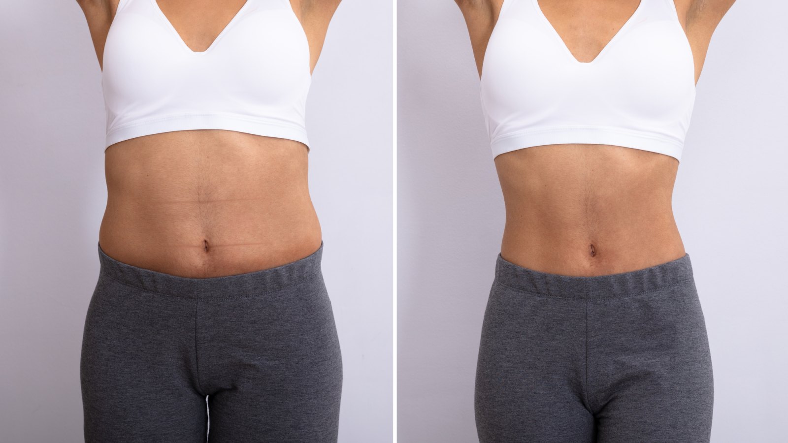 Before-After-Belly-Fat-Stock-Photo