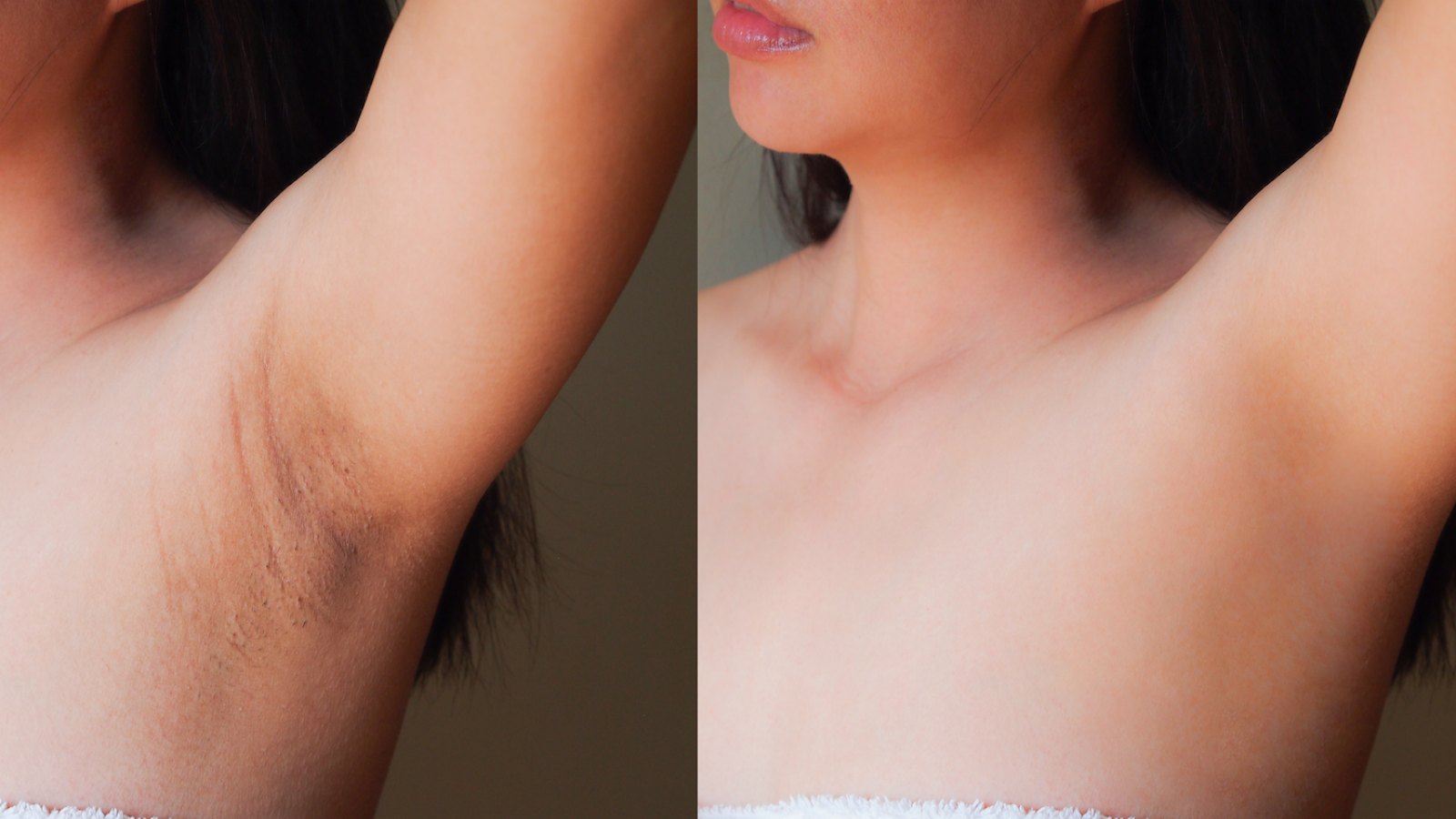 Dark-Spot-Correction-Before-After