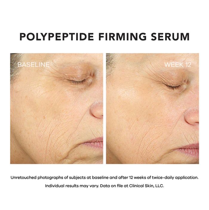 clinical-skin-polypeptide-serum-before-after