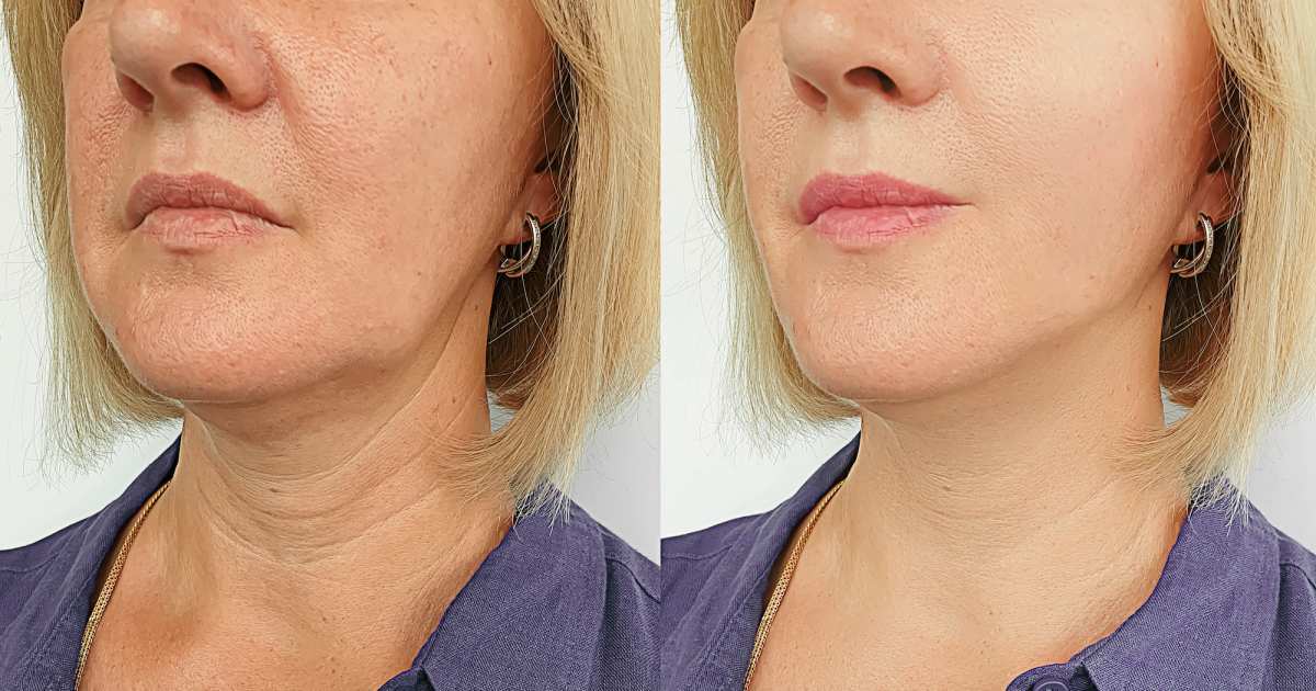 SKIN1004 Therapy Could Give You Face Carry Results in Simply 10 Minutes SKIN1004 Therapy Could Give You Face Carry Results in Simply 10 Minutes