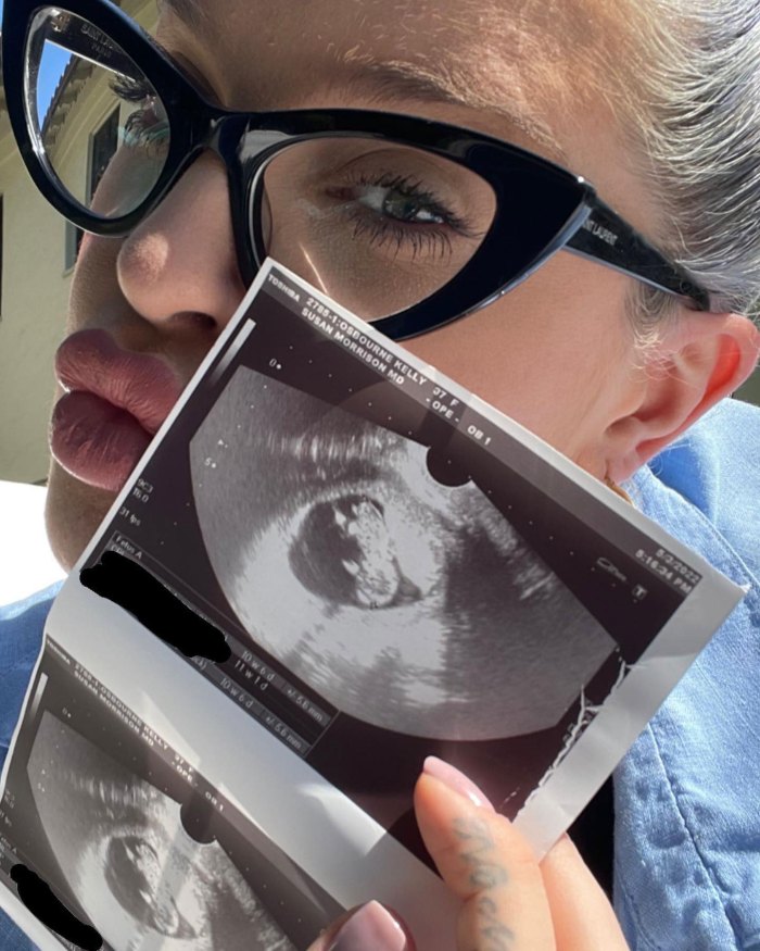 Kelly Osbourne Reveals Expecting a Baby Boy With Boyfriend Sid Wilson Pregnant 4