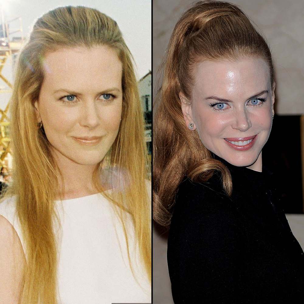 Nicole Kidman at 44: How Her Face Has Changed 1996 2009