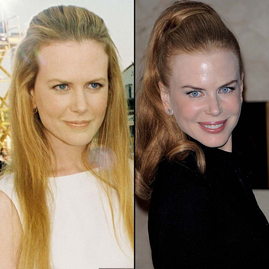 Nicole Kidman at 44: How Her Face Has Changed 1996 2009