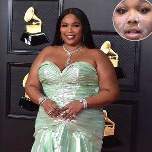 Promo Lizzo Gets Unready With Her TikTok Followers Talks Skin Issues on Tour