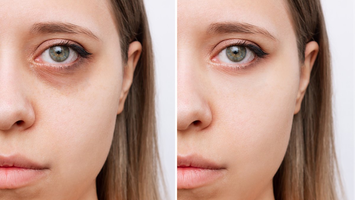 amazon-holiday-beauty-haul-under-eye-circles