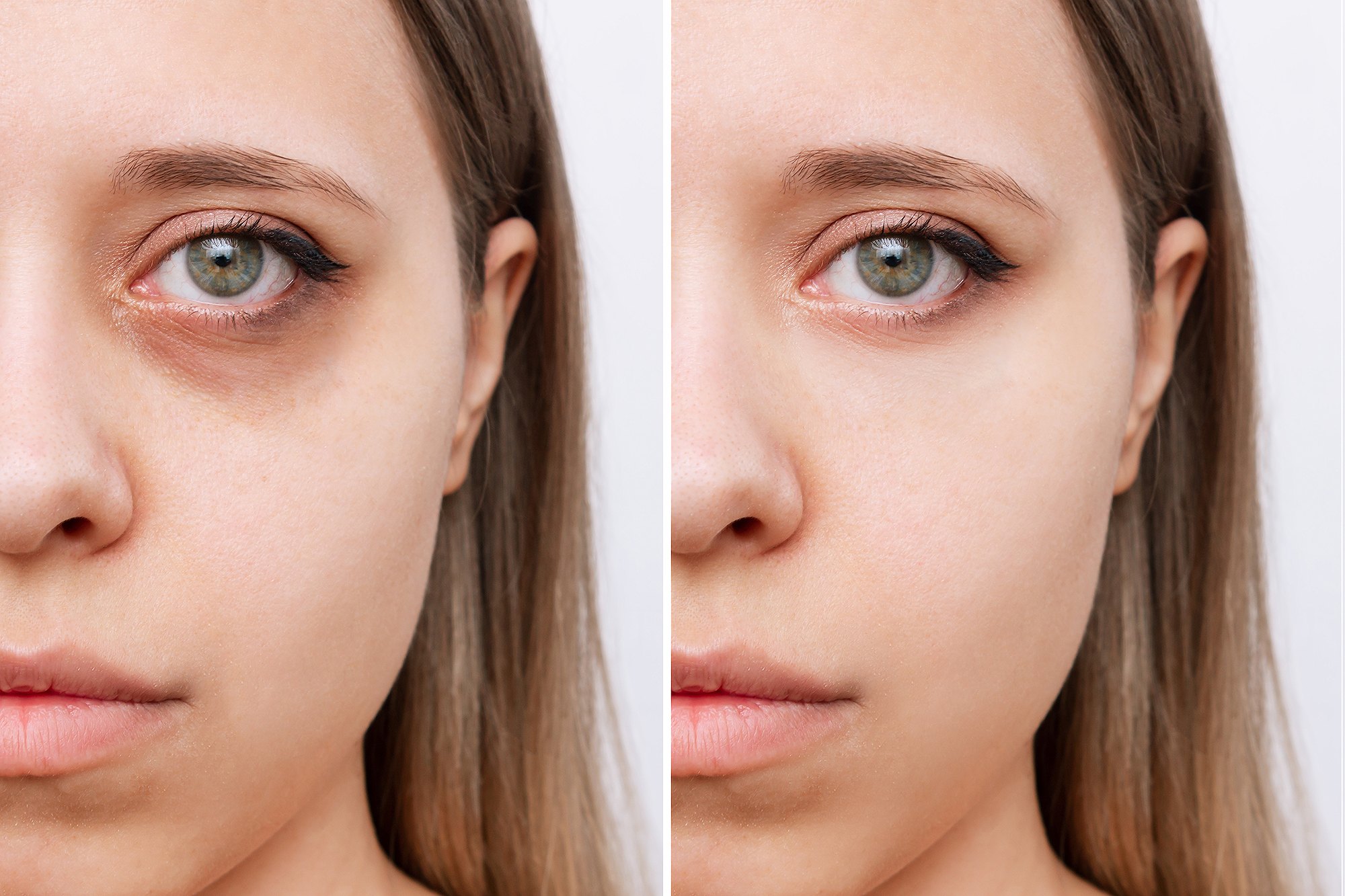 Amazon Holiday Beauty Haul: Best Deals for Under-Eye Circles