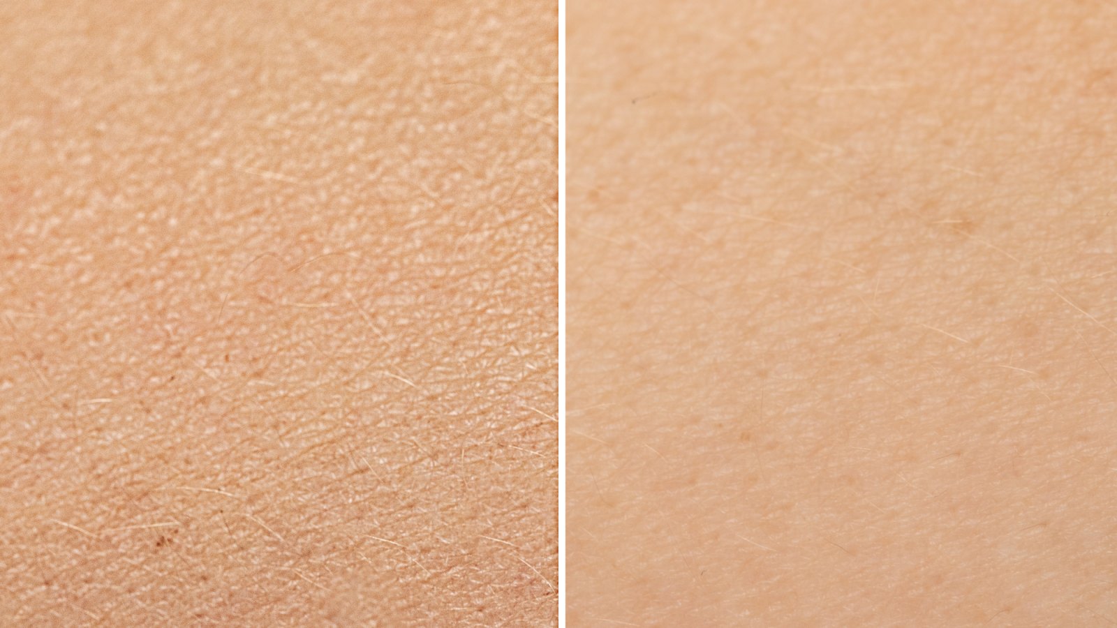 Before-After-Dry-Skin-Stock-Photo