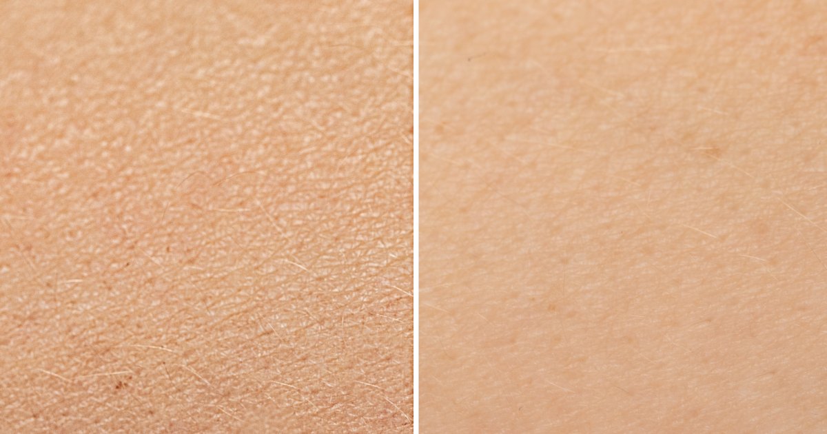 Mario Badescu Night time Cream Could Moisturize Pores and skin With out Clogging Pores Mario Badescu Night time Cream Could Moisturize Pores and skin With out Clogging Pores