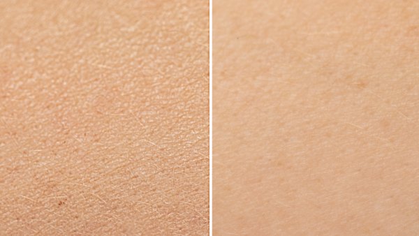 Before-After-Dry-Skin-Stock-Photo