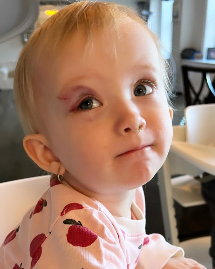 هیلاریا بالدوین فاش کرد که دخترش لوسیا در پاییز دچار سیاهی چشم شده است