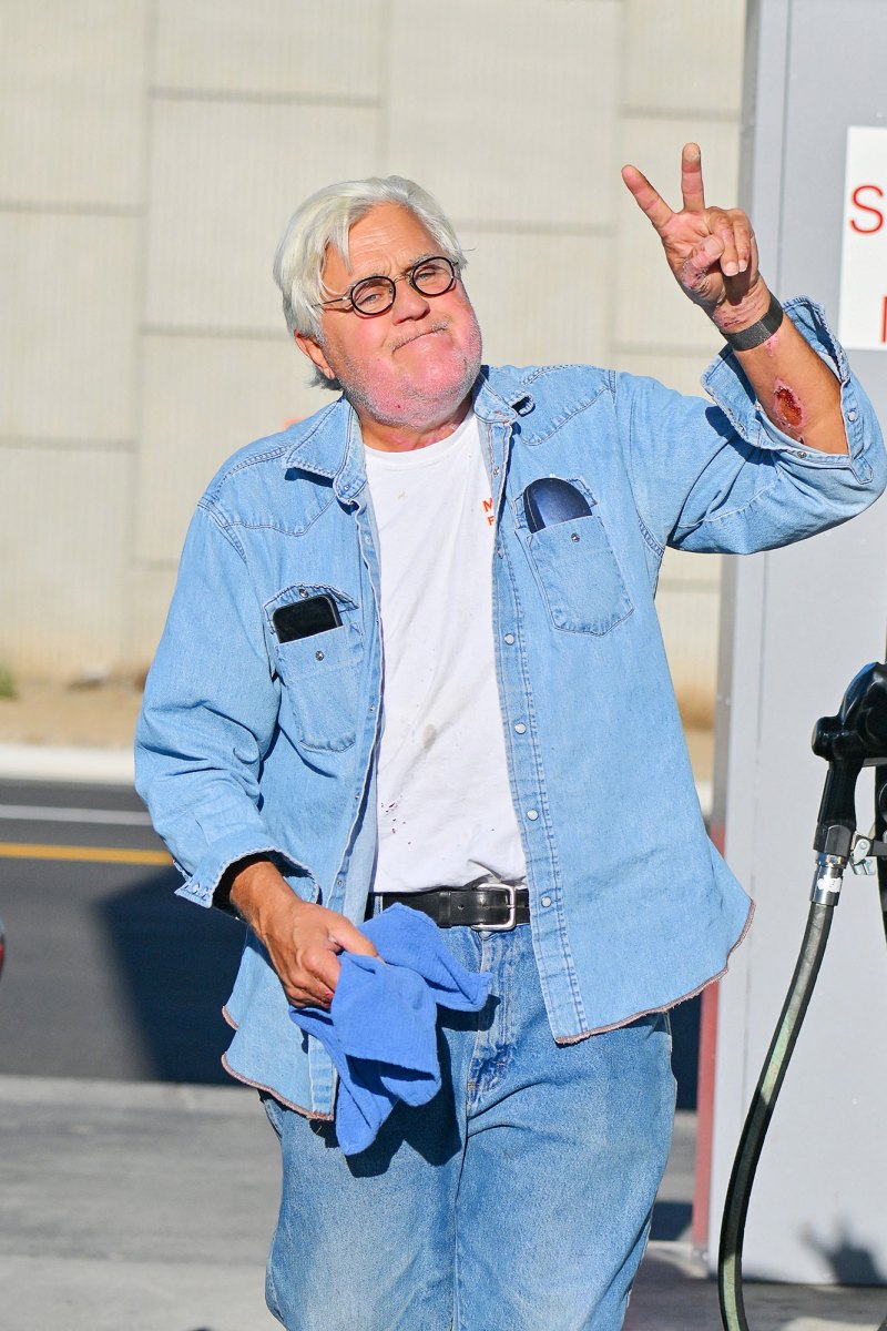 Jay Leno's Gasoline Fire Accident- What Happened, His Injuries and More 245
