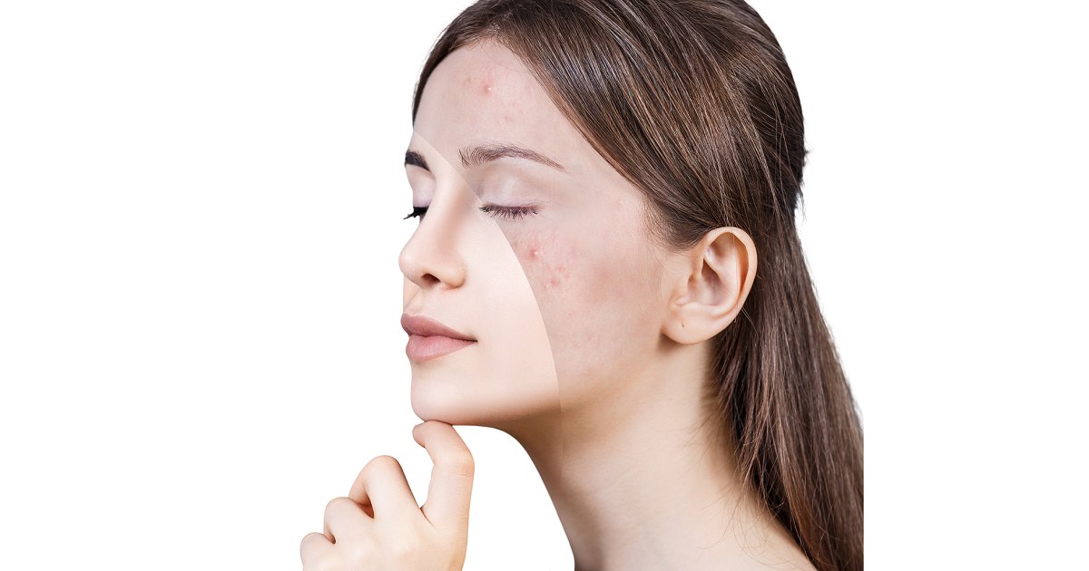 The Face Store Moisturizer Makes use of Rice Extract for Brighter Pores and skin The Face Store Moisturizer Makes use of Rice Extract for Brighter Pores and skin