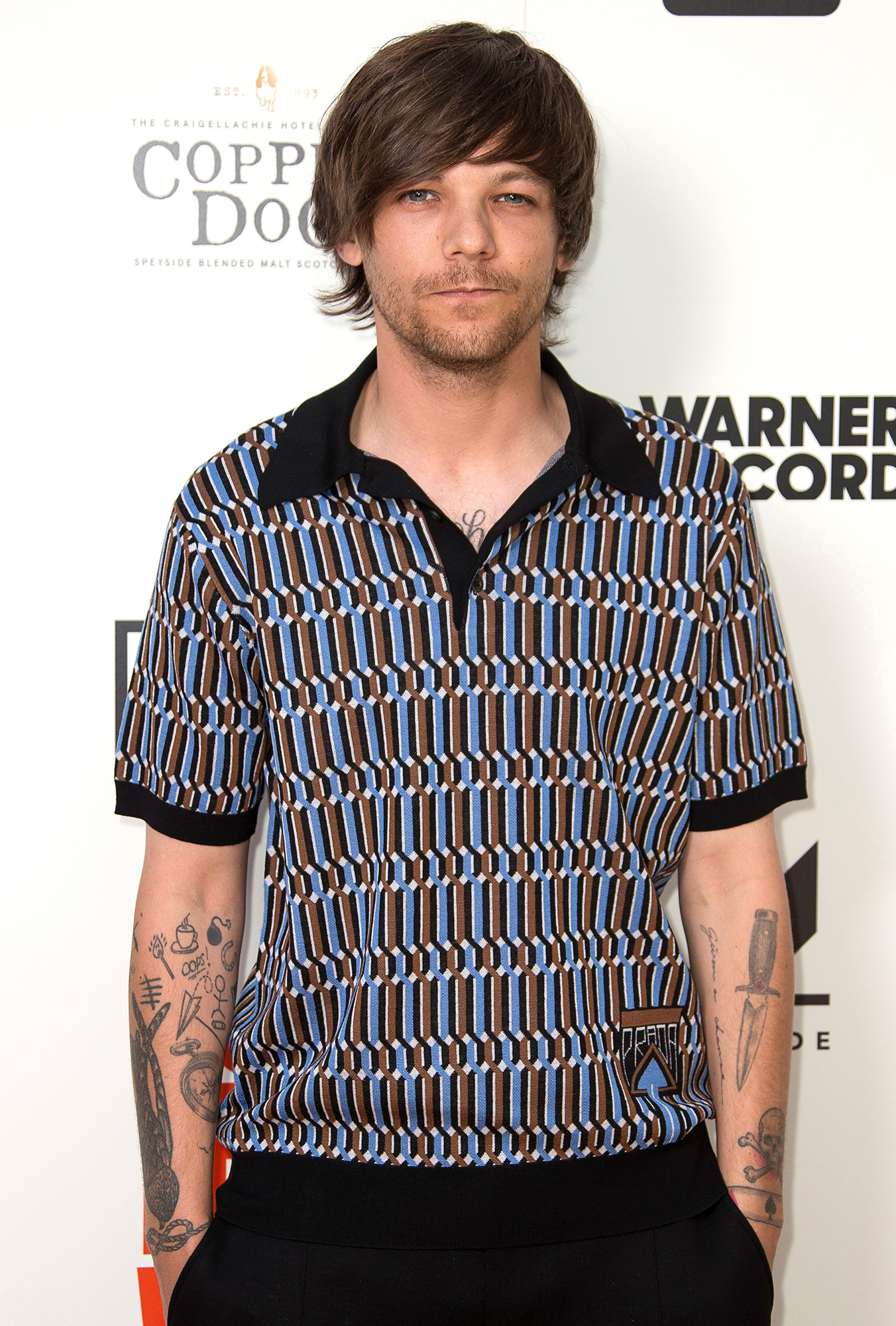 Louis Tomlinson Cancels Record Signings After Breaking Arm ‘Pretty Badly’
