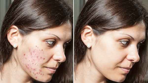 cerave-retinol-serum