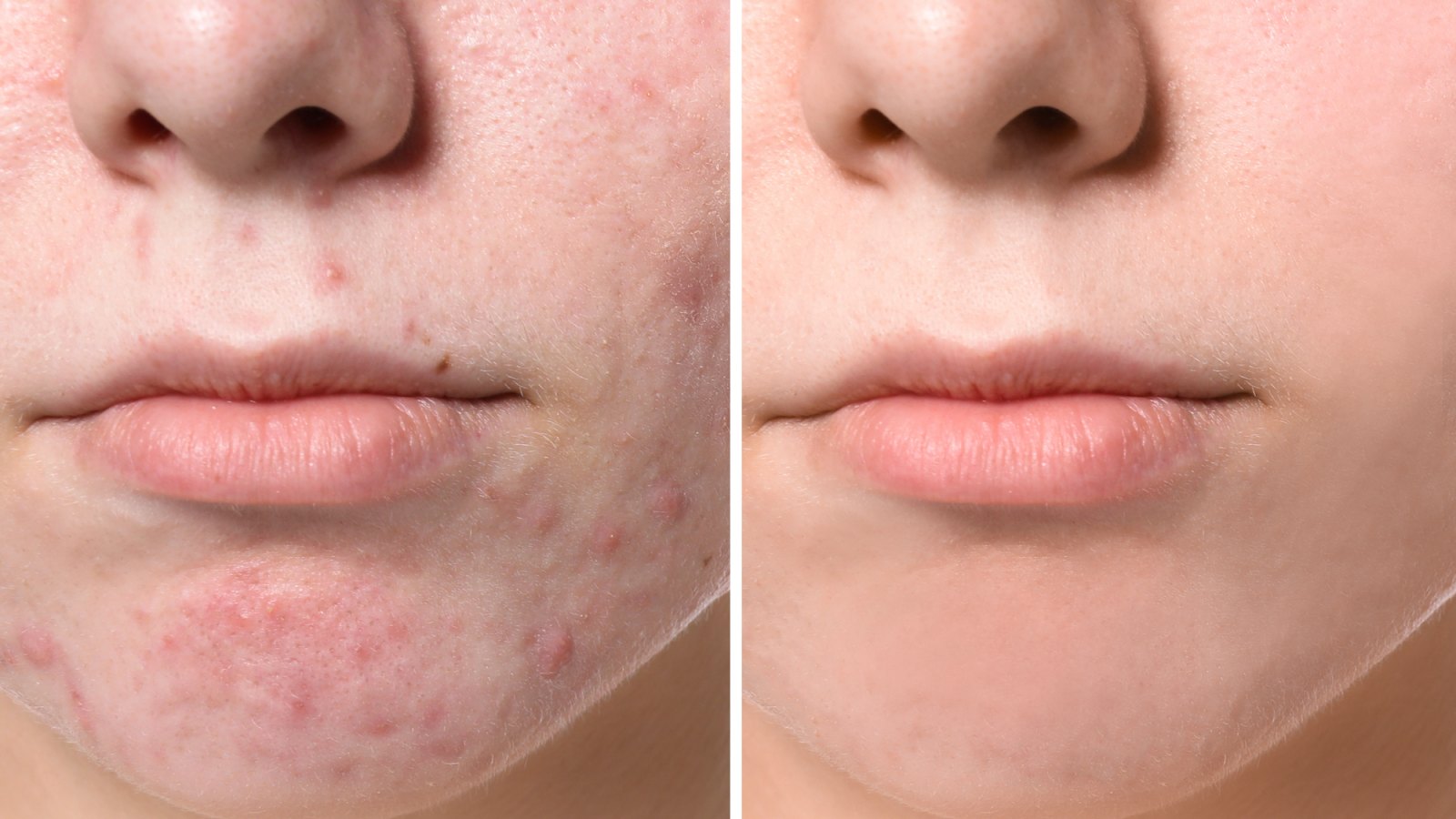 Before-After-Brightening-Serum-Stock-Photo