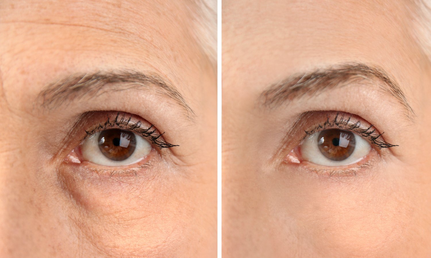 Before-After-Eye-Cream-Stock-Photo