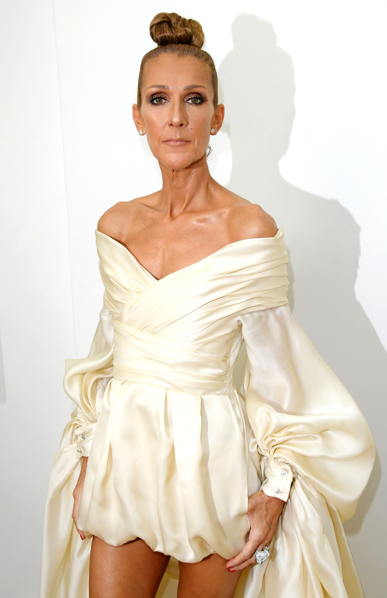 Celine Dion reveals she was diagnosed with rare neurological disease