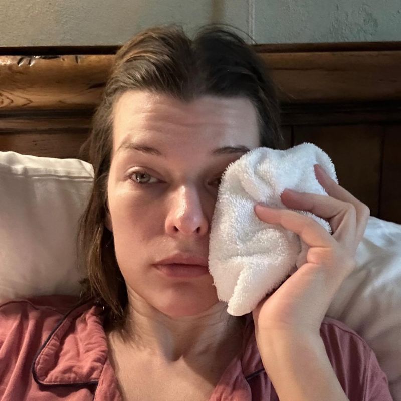 Milla Jovovich Instagram They Ice Their Injuries Just Like Us