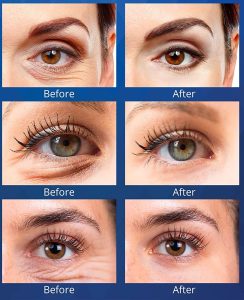 Wealthskin Rapid Rewind Wrinkle Reduction Eye Cream
