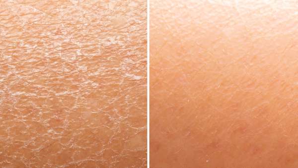 amazon-farmacy-honey-halo-moisturizer