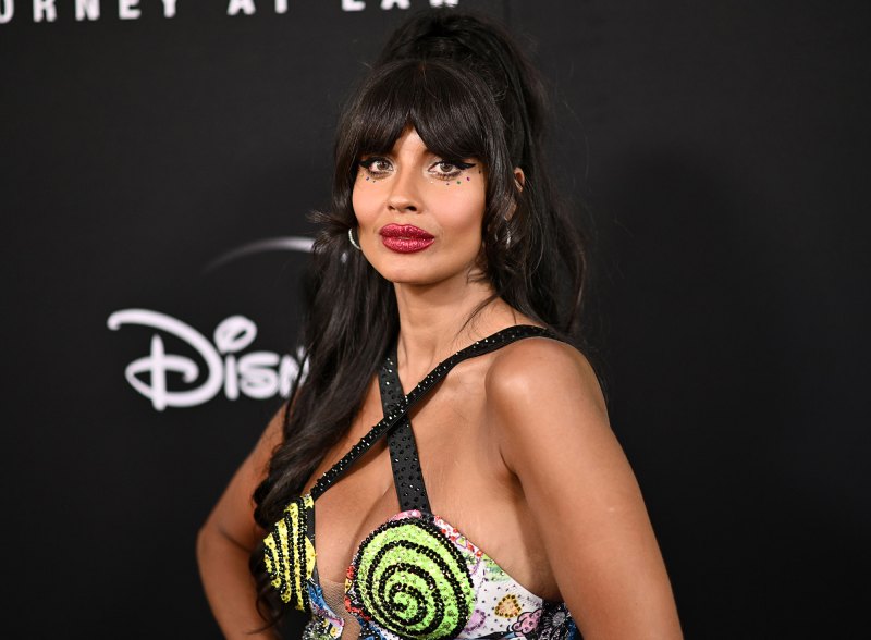 Jameela Jamil Gets Candid About 'Dangerous' Ehlers-Danlos Syndrome Diagnosis