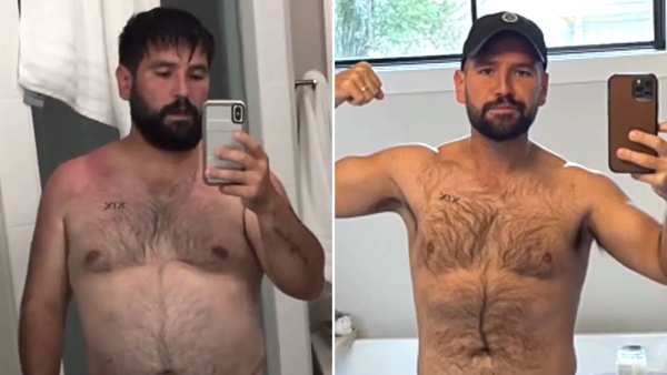 Dan + Shay’s Shay Mooney Reflects on 50-Pound Weight Loss: ‘It’s Weird Not Recognizing Yourself’