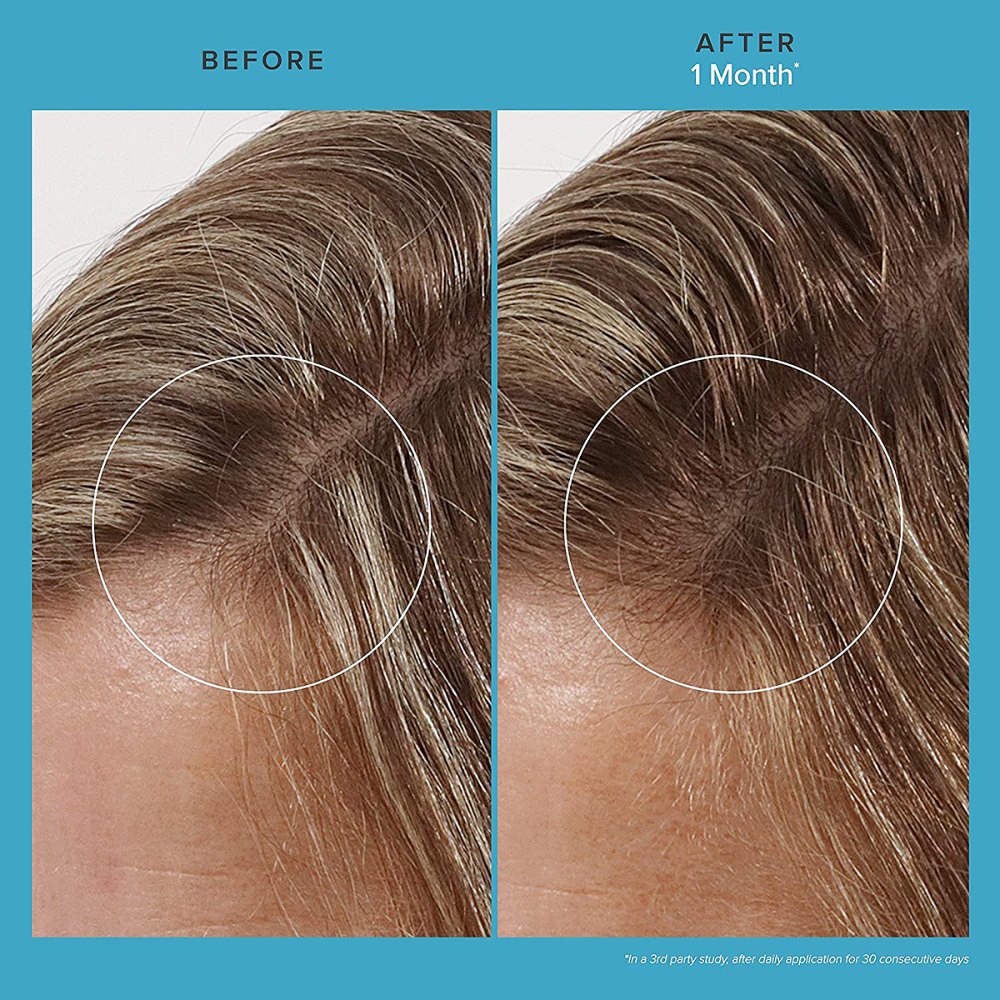 living-proof-revitalizing-scalp-treatment-before-after-1-month