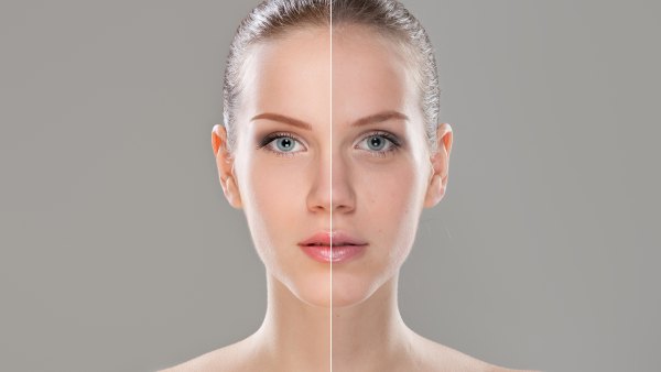 skincare before and after