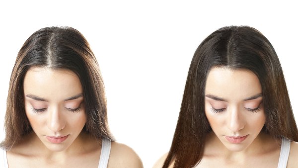 thin-hair-before-after