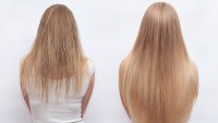 Before-After-Hair-Growth-Treatment