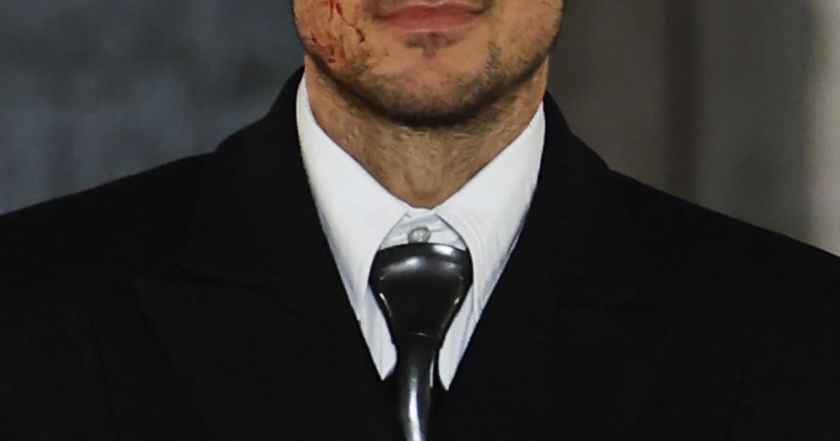 Lucas Bravo Rocks Bloody Face on Paris Vogue Week Runway: Pic Lucas Bravo Rocks Bloody Face on Paris Vogue Week Runway: Pic