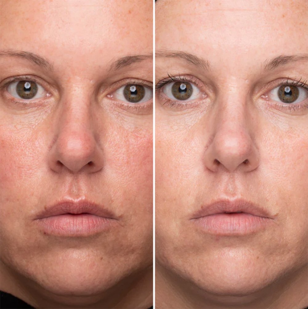 exponent-vitamin-c-skincare-system-before-and-after