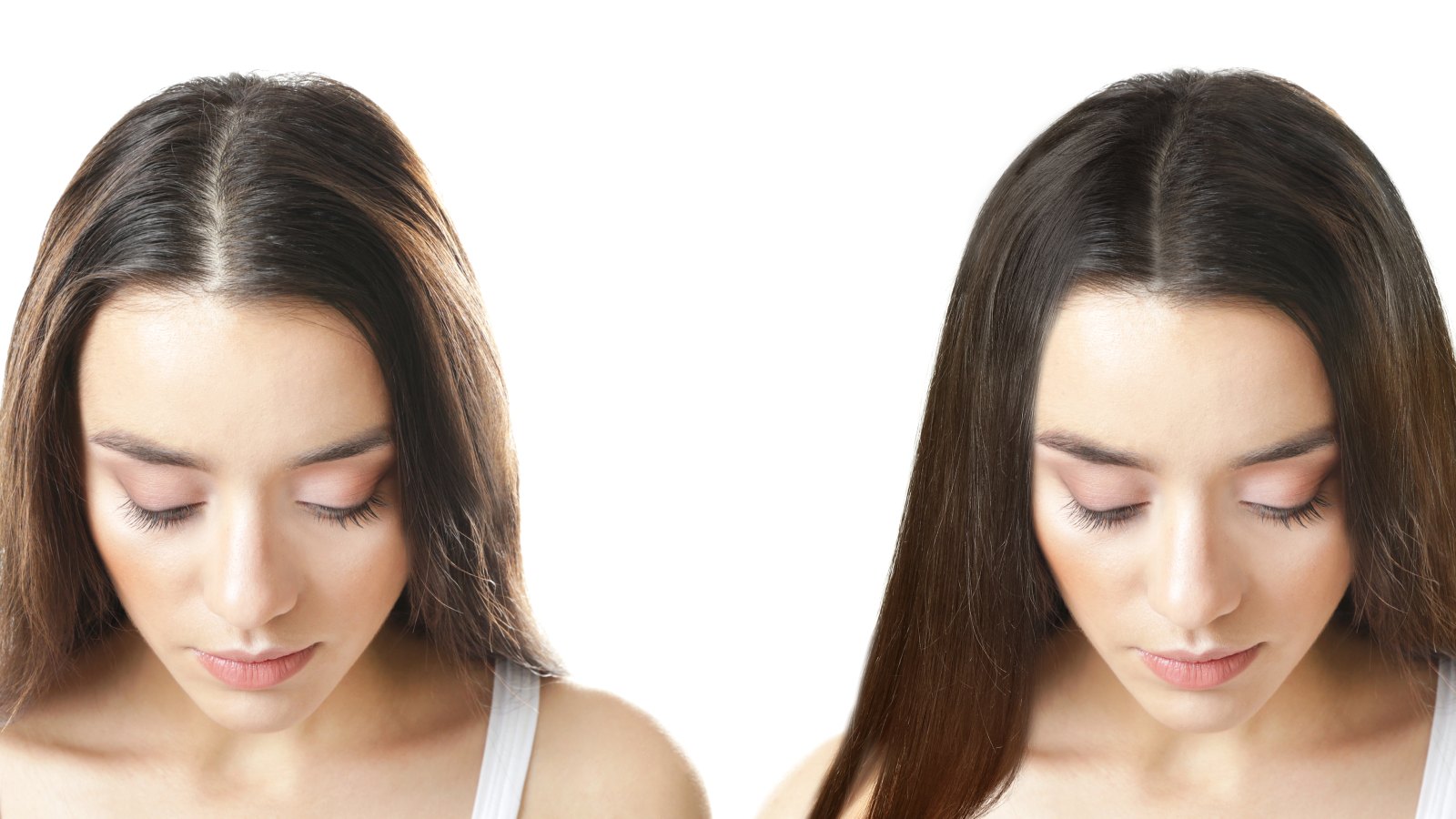 hair growth treatments