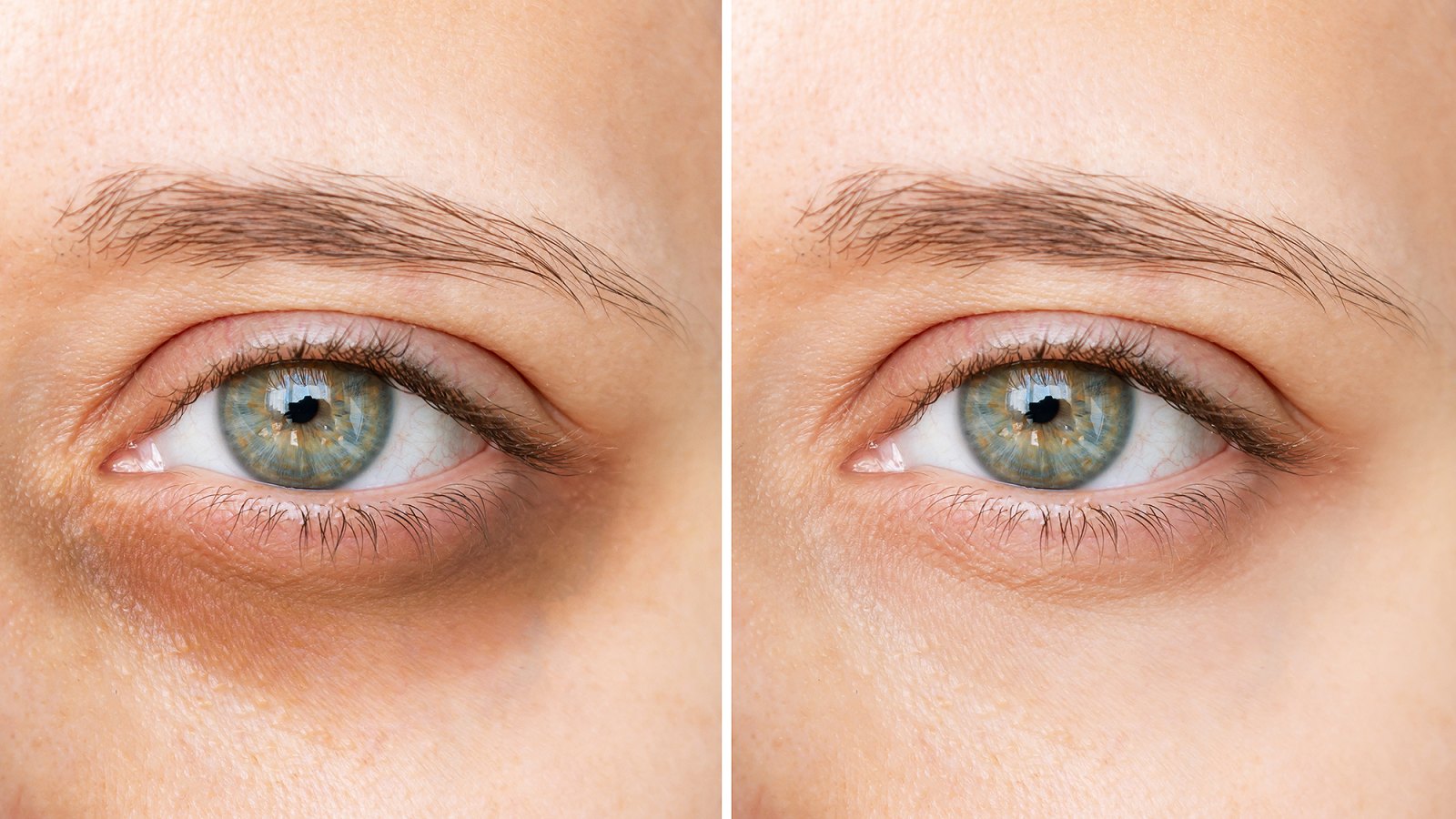 under-eye-before-after-concealer
