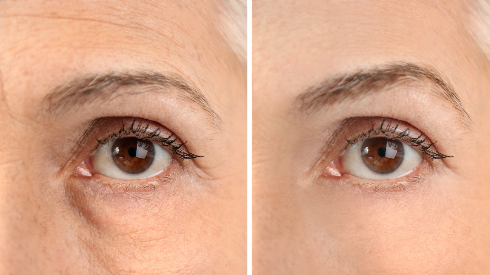 Before-After-Eye-Serum-Stock-Photo
