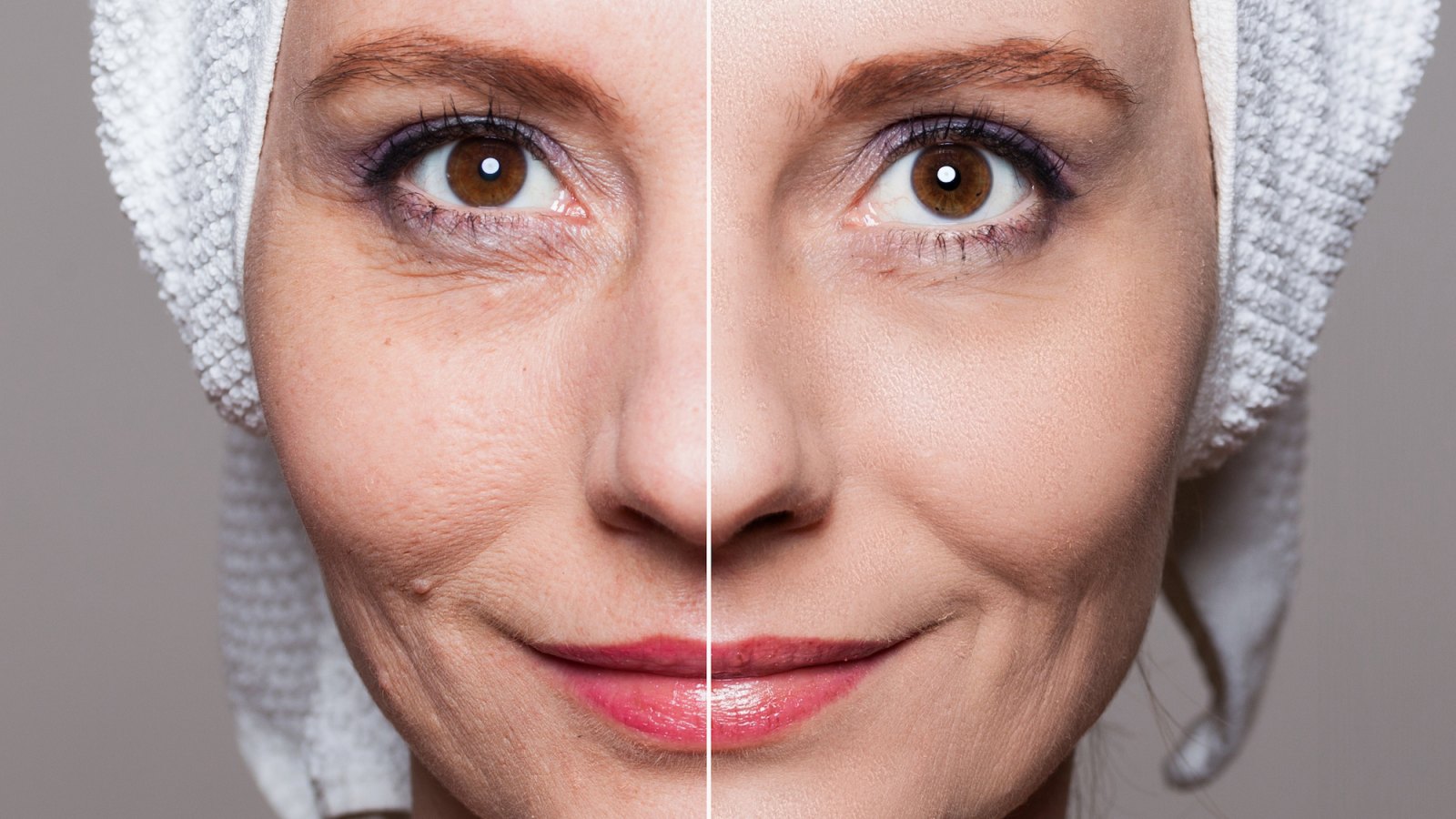Before-After-Facial-Treatment-Stock-Photo