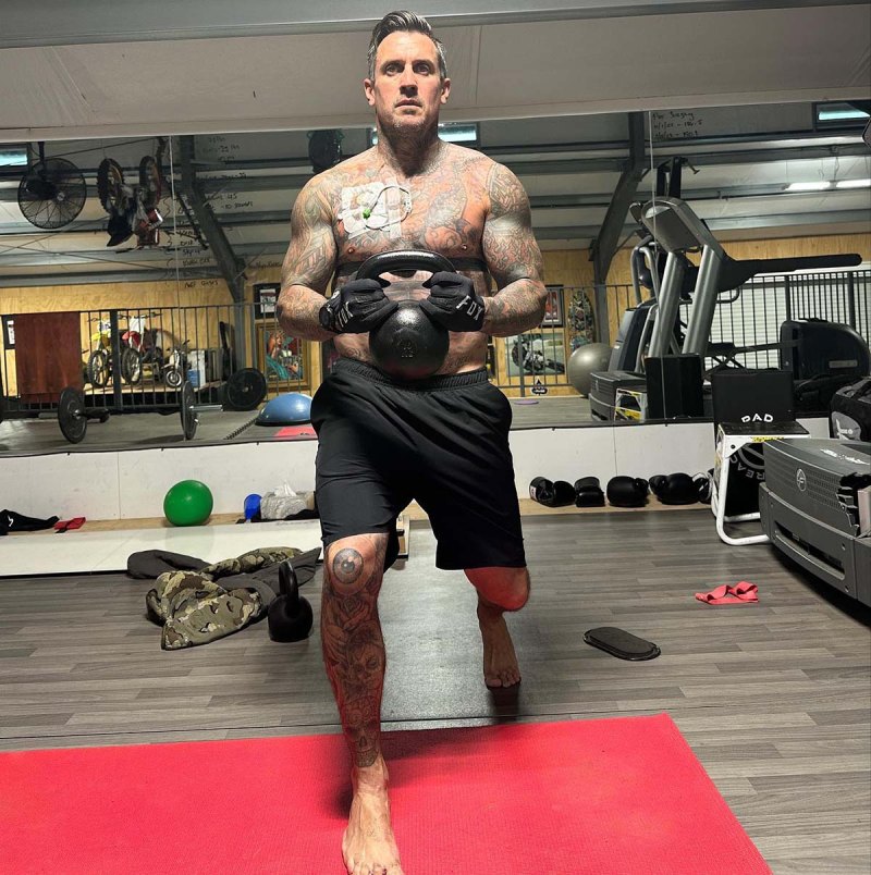 Carey Hart Lifts Weights After Getting Chest Catheter Placed
